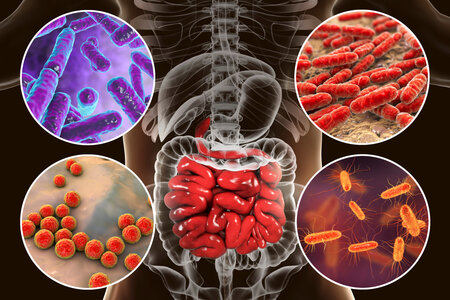 Přednáška - Hodní a zlí mikrobi u Crohnovy choroby